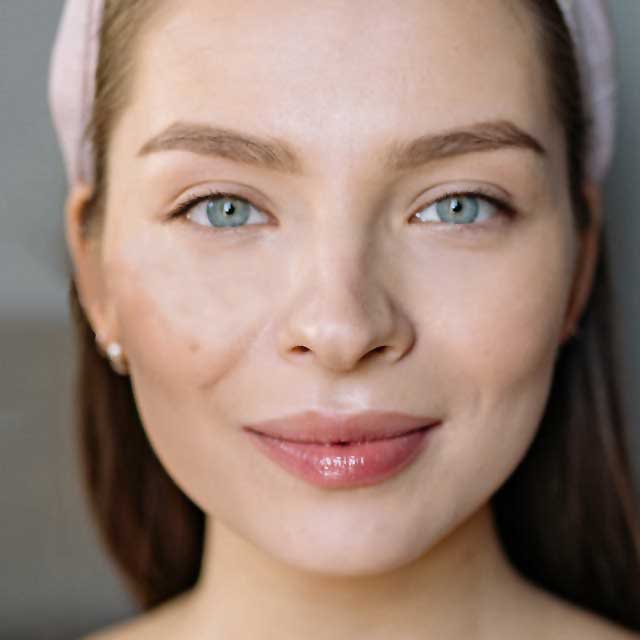 Botox and Dermal Fillers, Windsor, ON.